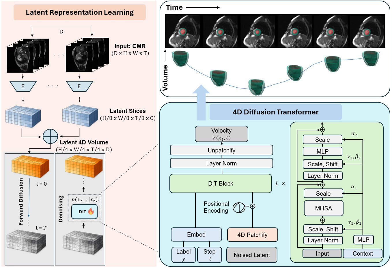 CardioDiT framework: encode 2D plus time slices, stack their latents into a full 4D volume, jointly denoise with a diffusion transformer, then decode.