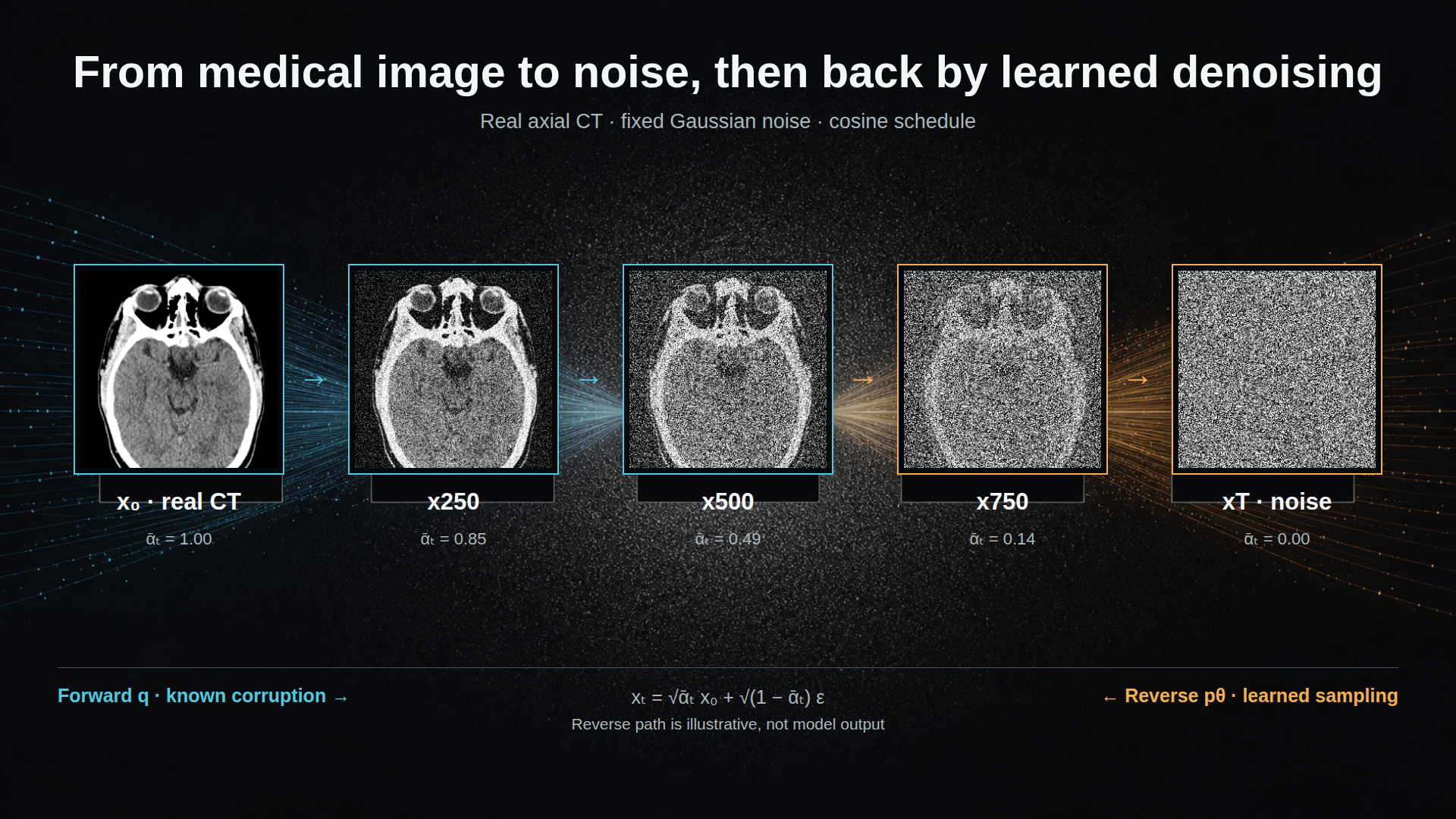 A real axial head CT at five diffusion timesteps from clean image to Gaussian noise, with arrows identifying forward noising and idealized reverse sampling.
